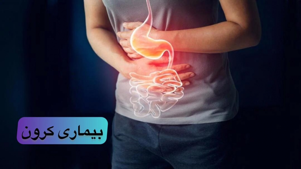 بیماری کرون