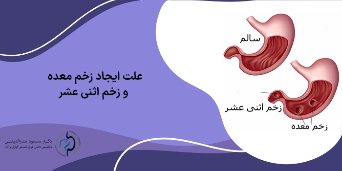 تفاوت زخم معده و زخم اثنی عشر در علائم