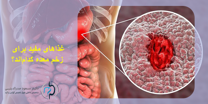 رژیم غذایی زخم معده