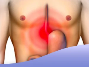 تاثیر سیگار بر زخم معده