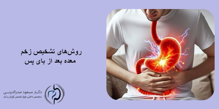 درمان زخم معده پس از بای پس
