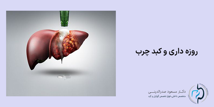 روزه داری و کبد چرب