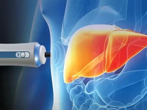 اقدامات قبل از فیبرواسکن کبد