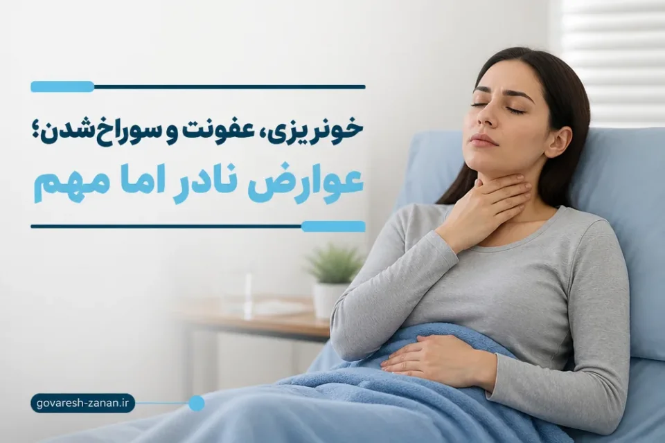 نمای توضیحی درباره خونریزی، عفونت و سوراخشدن؛ عوارض نادر اما مهم